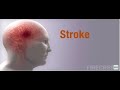 FIRECREST Medical Animations Stroke