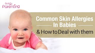 Common Skin Allergies in Babies & How to Treat Them