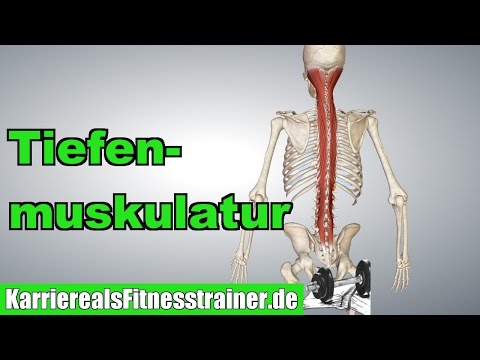 Was ist, wenn die wunden Ellenbogen nach dem Training zu tun Das muss getroffen werden, um nicht die Gelenke weh tun