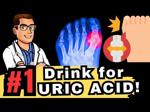 , title : 'TOP 5 Drinks to Reverse High URIC ACID & GOUT!'