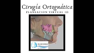 Maxilofacial Saltillo Cirugía Ortognática y Estética de Mínima Invasión - Laura Gabriela González Valdez