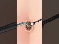 ASMR Navel Stone Belly Button Ring Remove Animation
