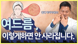 여드름 금지 사항