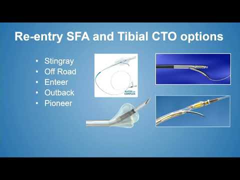 CVI 2019_Thursday 7/18_ Masters Approach to CLI I_Tony Das, MD