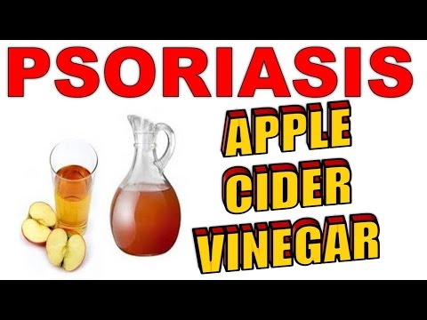 Das Ekzem die Weisen der Ansteckung Das Ekzem und das Salzwasser