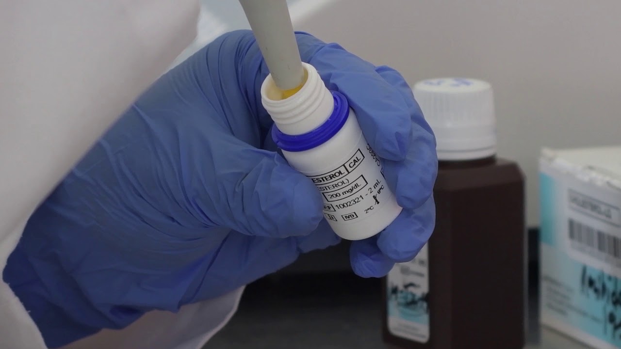 Practica 7 Perfil de Lípidos