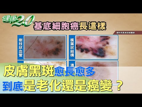 身體長黑斑