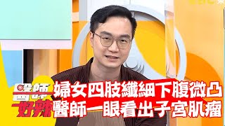 婦女四肢纖細下腹微凸 醫師一眼就看出是「子宮肌瘤」？！【#醫師好辣】20220606 part4 EP1344 Teddy 洪永祥