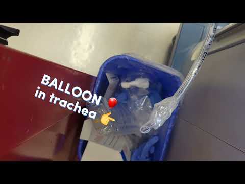 Balloon in patient's trachea