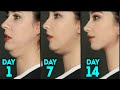 DOUBLE CHIN FAT FACE LIFT BEST FACIAL EXERCISES