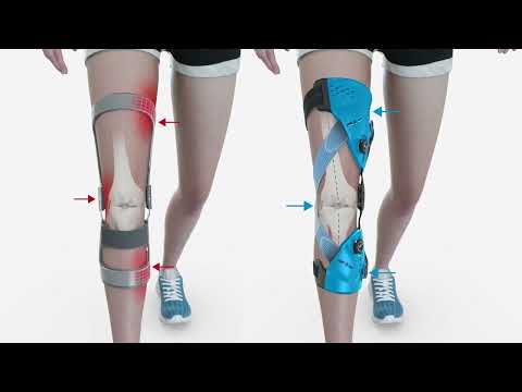 Unloader One X (Animation)