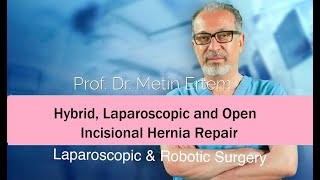 Miniaturka - Hybrid Laparoscopic Incisional Hernia Repair .Metin Ertem MD.FACS