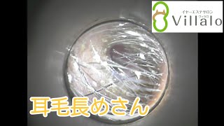 耳掃除動画vol.62「耳毛長めさん」