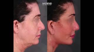 Nassif MD Plastic Surgery