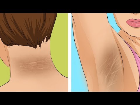 Shadberry in Typ 1 Diabetes Warum häufiges Urinieren bei Diabetes