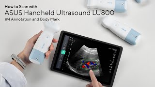 Asus Handheld Ultrasound LU800 Tutorial #4 Annotation