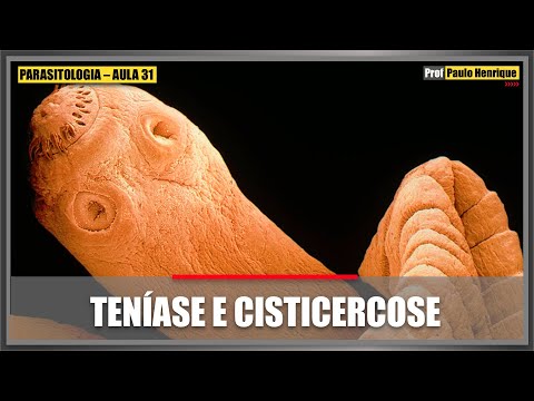 PARASITOLOGIA: TENÍASE E CISTICERCOSE | PAULO HENRIQUE