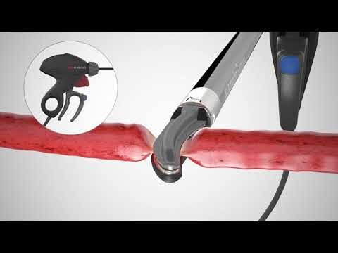 marSeal5 plus | marSeal5 plus Maryland | Effective and safe!