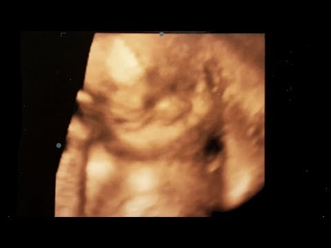 Click to Watch the Almost half-a-million signatures for Pro-Life petition in Argentina video