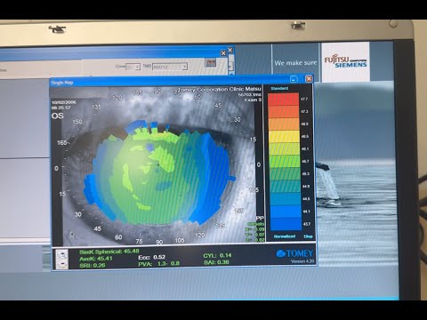 SAS EasyOpto EasyAudio AideOphta Miniature vidéo YouTube 21