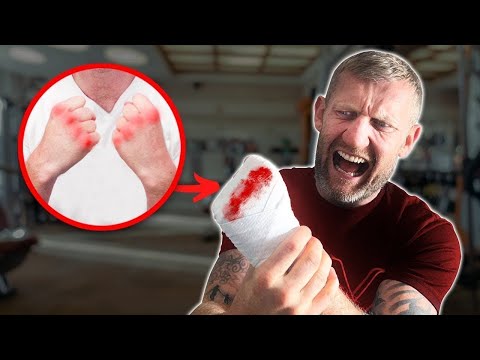 Stop Grazing your Knuckles in Boxing Training (Quick Fix)