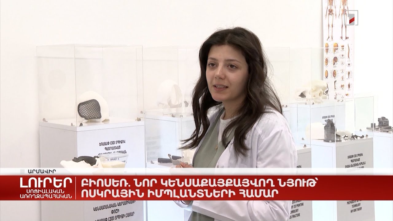 Բիոսեռ. նոր կենսաքայքայվող նյութ՝ ոսկրային իմպլանտների համար