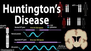 Huntington&#39;s Disease, Genetics, Pathology and Symptoms, Animation