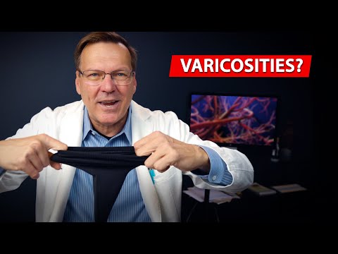 Venous Insufficiency & Tips to Make Your Veins Healthy