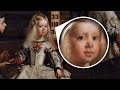 Did You Know: The IV Was Invented in 1656?