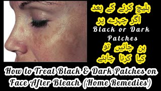 How to remove black patches from face after bleach|treat dark spots after face bleach|Home Remedies