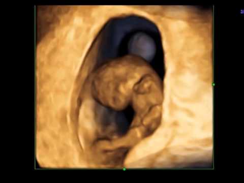 Embarazo de 8 semanas