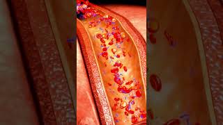 This Common Vitamin Cleans Your Arteries #natural #remedy