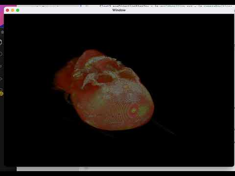 保健学科 3D texture Volume Rendering