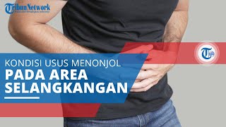 Hernia Inguinalis, Jaringan Lunak dalam Tubuh Menonjol Melalui Bagian yang Lemah di Bawah Perut