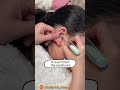Worried About Q-Tip Dangers? Try the Baby Ear Cleaning Tool with Light! #babycare #earwaxremoval