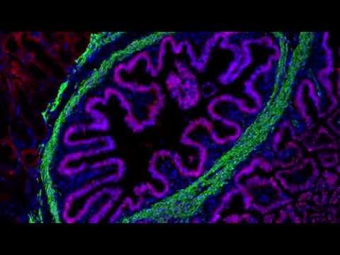  Human Intestines Grown in Mice - Video Series