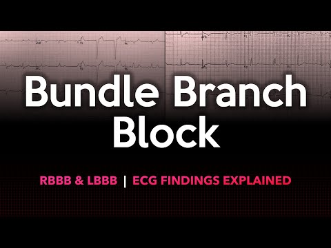 Left and Right Bundle Branch Block: ECG Made Easy