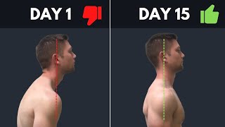 SUPER SIMPLE & Effective Fix For Rounded Shoulders & Forward Head Posture