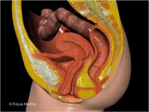 Anal sphincter dysplasia - Gastroenterology