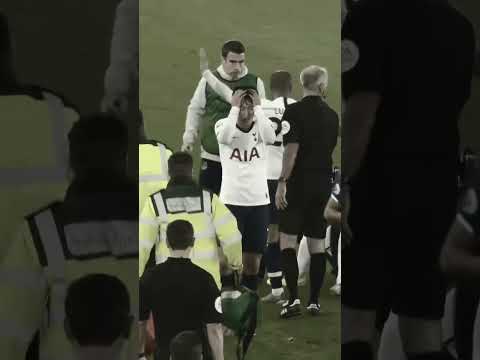 Son’s Brutal Tackle on André Gomes 😱⚽ | Shocking Ankle Break!