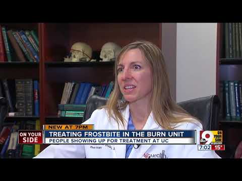 Treating frostbite at UCMC's burn unit