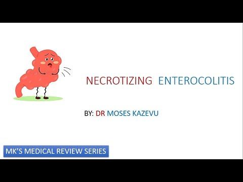 Necrotizing enterocolitis