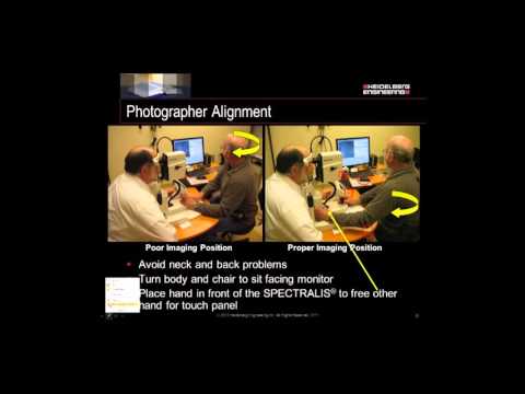 Optimizing IR and OCT Imaging With the SPECTRALIS®