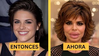 15 Actores Famosos Cuyas Carreras Colapsaron Tras la Cirugía Plástica | Antes y Después 2025