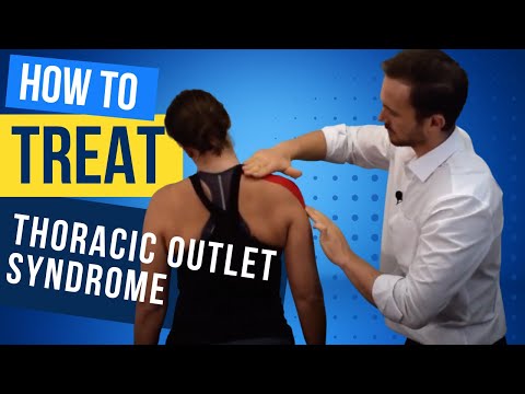 Treat Thoracic Outlet Syndrome at Home