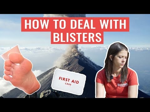 Should You Pop A Blister? | HOW TO Deal With Blisters