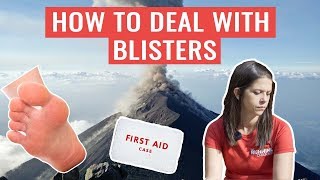 Should You Pop A Blister? | HOW TO Deal With Blisters