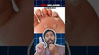 Download lagu Menghilangkan MATA IKAN TANPA OPERASI, begini caranya #tipssehat #faktaunik mp3 Download lagu Menghilangkan MATA IKAN TANPA OPERASI, begini caranya #tipssehat #faktaunik mp3