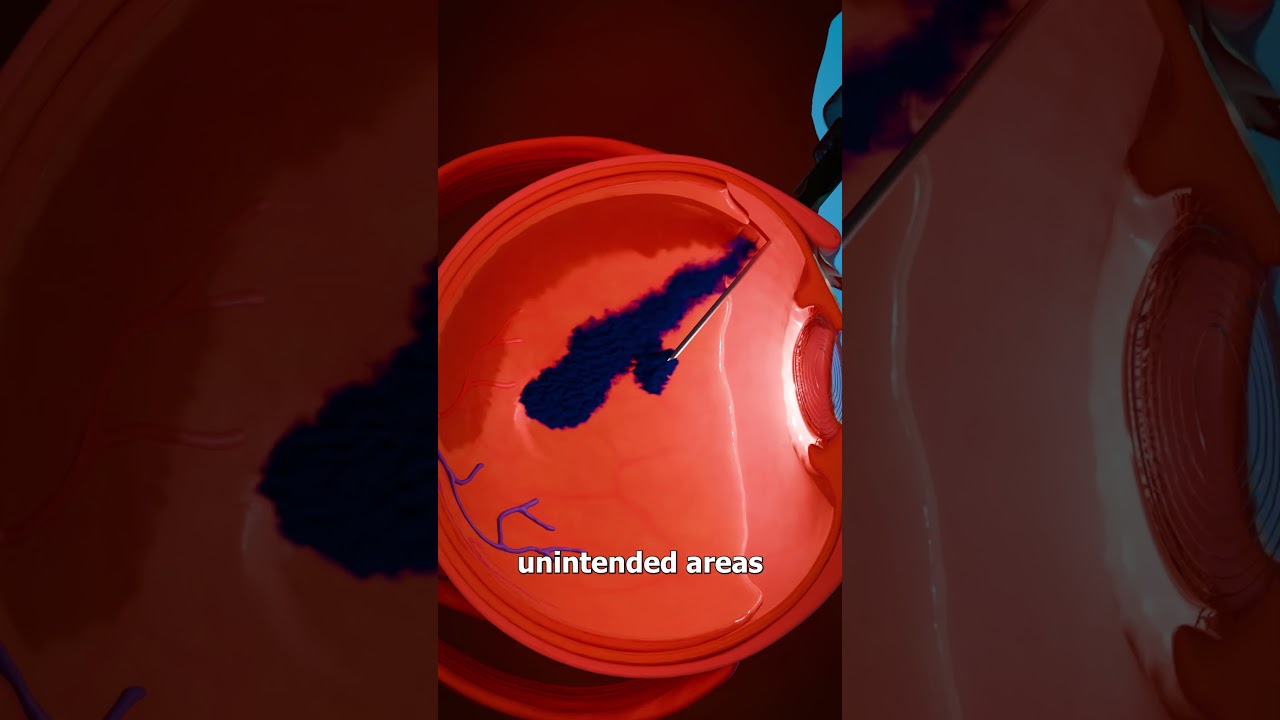 How Tattooing An Eyeball Works 😨