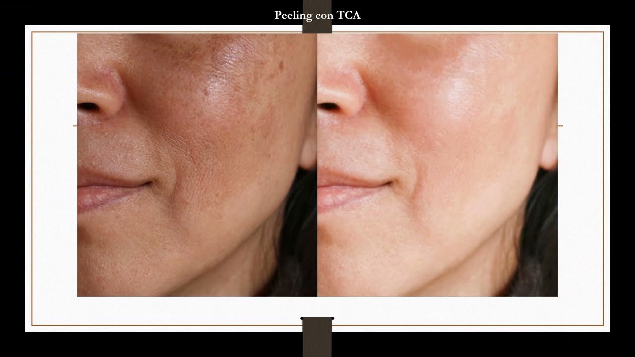 Raffaele Lopreiato-3